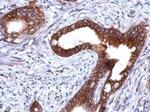 PKP1 Antibody in Immunohistochemistry (Paraffin) (IHC (P))