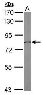 DDX3 Antibody in Western Blot (WB)