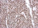 YY1 Antibody in Immunohistochemistry (Paraffin) (IHC (P))