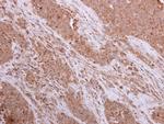 CK2 alpha-1 Antibody in Immunohistochemistry (Paraffin) (IHC (P))