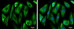 GSK3B Antibody in Immunocytochemistry (ICC/IF)