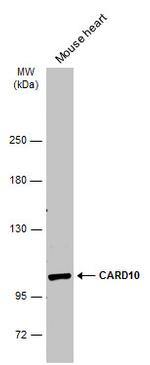 CARD10 Antibody in Western Blot (WB)