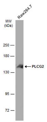 PLCG2 Antibody in Western Blot (WB)