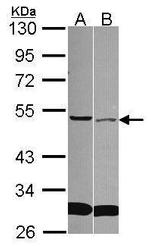 SFRP4 Antibody in Western Blot (WB)