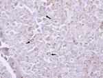 PIP5K1A Antibody in Immunohistochemistry (Paraffin) (IHC (P))