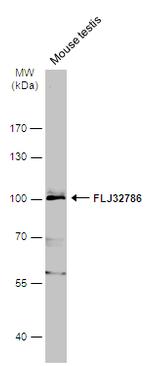 LRGUK Antibody in Western Blot (WB)