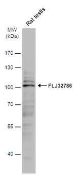 LRGUK Antibody in Western Blot (WB)