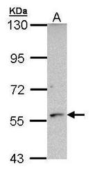 CYP21A2 Antibody in Western Blot (WB)