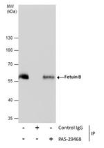 Fetuin B Antibody in Immunoprecipitation (IP)