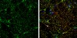 CRMP5 Antibody in Immunocytochemistry (ICC/IF)