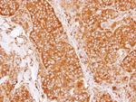 CRMP5 Antibody in Immunohistochemistry (Paraffin) (IHC (P))