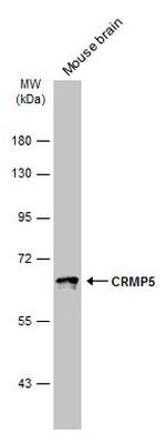 CRMP5 Antibody in Western Blot (WB)