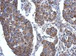 ACSL3 Antibody in Immunohistochemistry (Paraffin) (IHC (P))