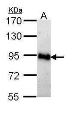 AMPD2 Antibody in Western Blot (WB)