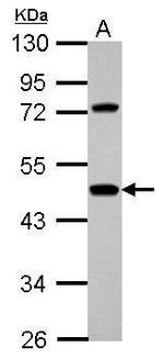 Hemopexin Antibody in Western Blot (WB)