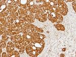 ERO1L Antibody in Immunohistochemistry (Paraffin) (IHC (P))