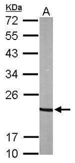 p23 Antibody in Western Blot (WB)