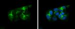 ApoA1 Antibody in Immunocytochemistry (ICC/IF)