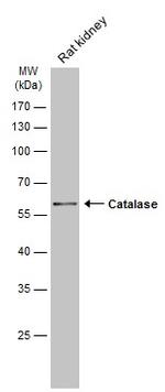 Catalase Antibody in Western Blot (WB)