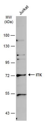 ITK Antibody in Western Blot (WB)