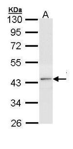 THRB Antibody in Western Blot (WB)