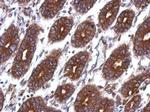 TK1 Antibody in Immunohistochemistry (Paraffin) (IHC (P))