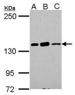 CARD11 Antibody in Western Blot (WB)