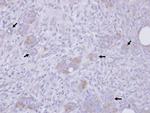 Stathmin 1 Antibody in Immunohistochemistry (Paraffin) (IHC (P))