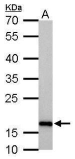 Stathmin 1 Antibody in Western Blot (WB)