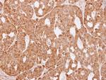 AKR1C3 Antibody in Immunohistochemistry (Paraffin) (IHC (P))