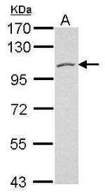 PKD2 Antibody in Western Blot (WB)