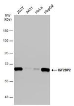 IGF2BP2 Antibody in Western Blot (WB)