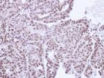 TRIB3 Antibody in Immunohistochemistry (Paraffin) (IHC (P))