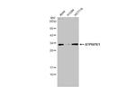 V-ATPase E1 Antibody in Western Blot (WB)