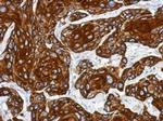 Cytokeratin 17 Antibody in Immunohistochemistry (Paraffin) (IHC (P))