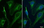 ATP6IP2 Antibody in Immunocytochemistry (ICC/IF)