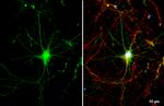 ATP6IP2 Antibody in Immunocytochemistry (ICC/IF)