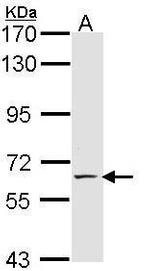 E-selectin Antibody in Western Blot (WB)