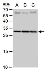 SLC25A6 Antibody in Western Blot (WB)