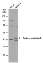 Carboxypeptidase B1 Antibody in Western Blot (WB)