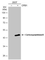 Carboxypeptidase B1 Antibody in Western Blot (WB)