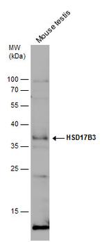 HSD17B3 Antibody in Western Blot (WB)