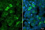 P2Y2 Antibody in Immunocytochemistry (ICC/IF)