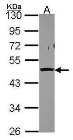 PSMC5 Antibody in Western Blot (WB)