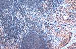 SATB1 Antibody in Immunohistochemistry (Paraffin) (IHC (P))