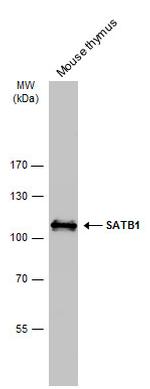 SATB1 Antibody in Western Blot (WB)