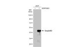 SERPINB3 Antibody in Western Blot (WB)