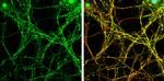 MUNC18 Antibody in Immunocytochemistry (ICC/IF)