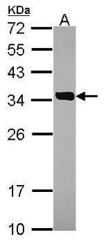 SULT2A1 Antibody in Western Blot (WB)