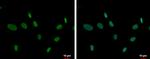 ZNF74 Antibody in Immunocytochemistry (ICC/IF)